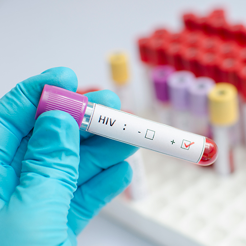 La lucha continúa: visibilizar, prevenir y avanzar contra el SIDA